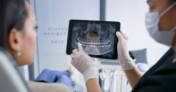 Licensed Tooth Extraction service in Peabody, MA - Smile Center Dentistry